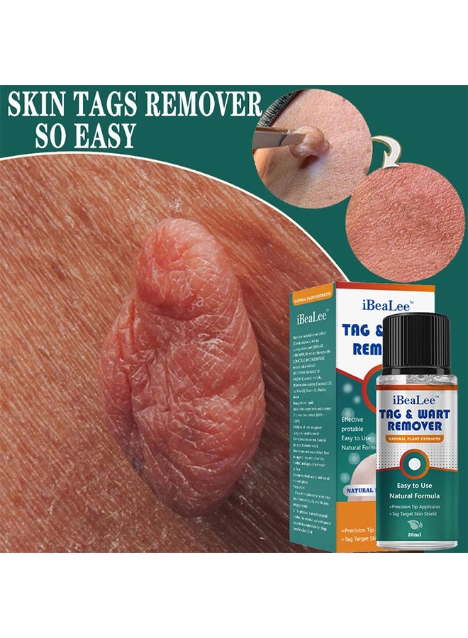 iBealee Natural & Safe Wart And Mole Remover Liquid, Wart Remover Liquid, Salicylic Acid Fast-Acting Formula For Plantar Warts, Skin Tags, Corns & Callus Removal, Pain-Free Scar-Free Treatment, Toes & Foot Care For Men & Women, 20ml - Image 3